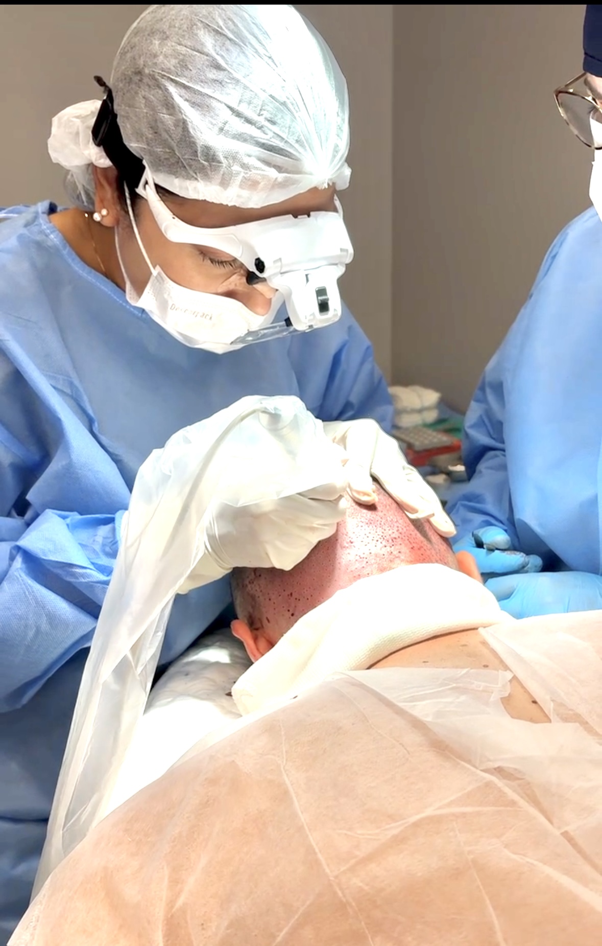 Dra. Larissa Belarmino — Dermatologista especialista em tricologia realizando procedimento capilar em Ipanema, RJ